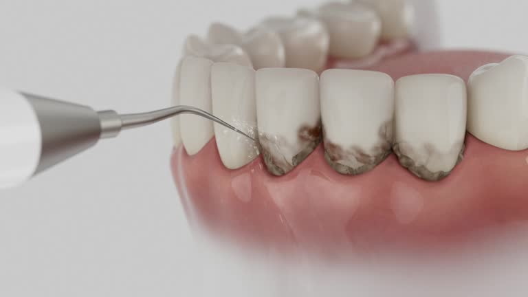 Trusted Root Canal Treatment service in Fountain Hill, PA - Dentist Open Now